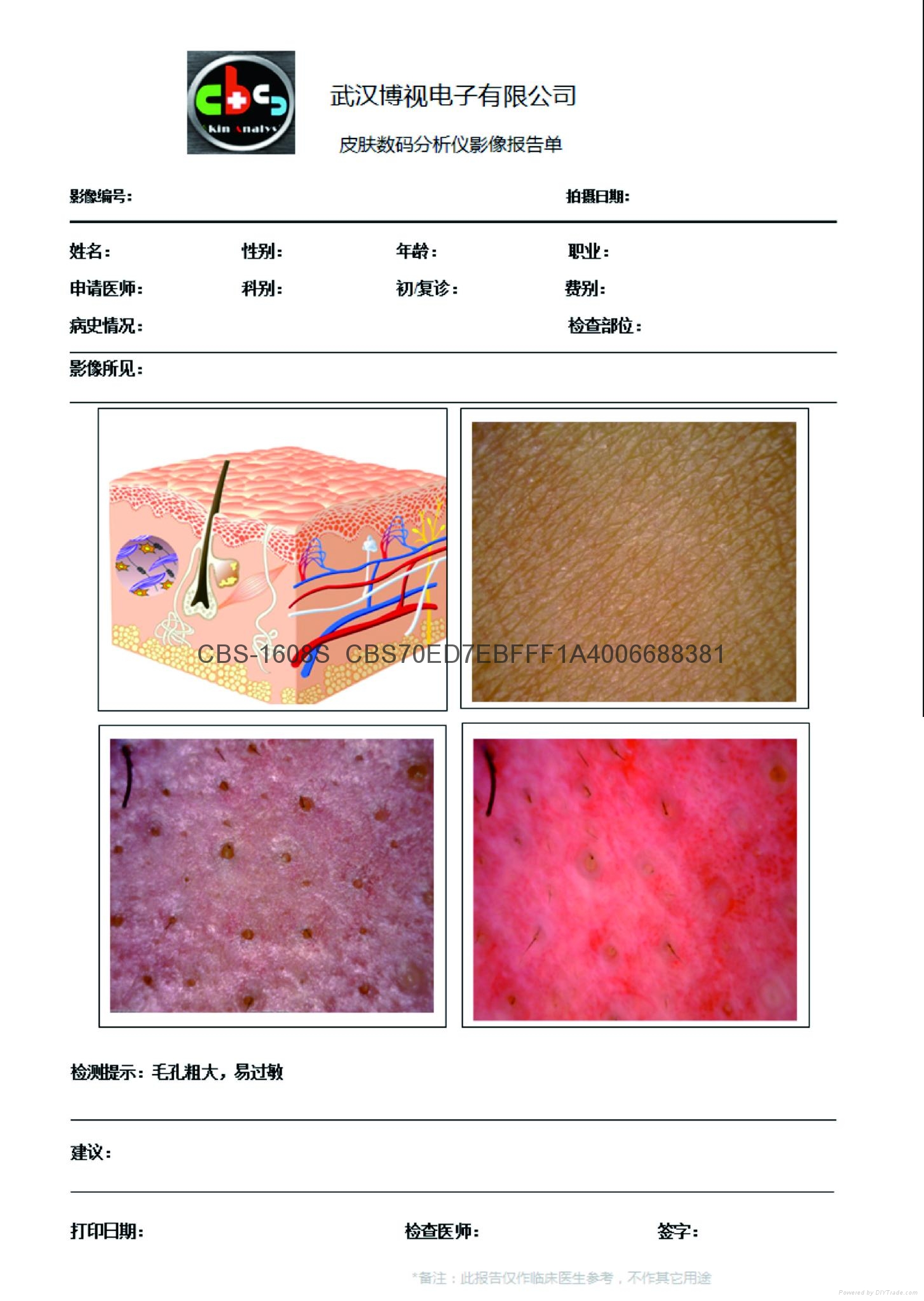 皮膚測試儀圖片/皮膚測試儀樣板圖 (1)