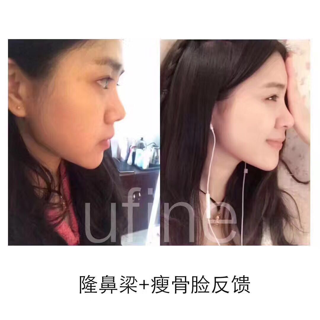 ufine優(yōu)梵精油小伴侶有激素嗎圖片/ufine優(yōu)梵精油小伴侶有激素嗎樣板圖 (4)