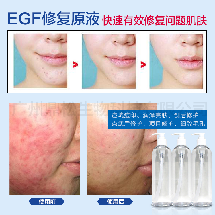 EGF修复原液医美级去痘印修复细致毛孔滋润皮肤工厂批发贴牌加工