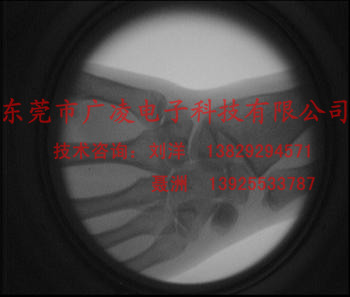 X光射線探傷儀 便攜式射線探傷儀 x-ray檢測方案