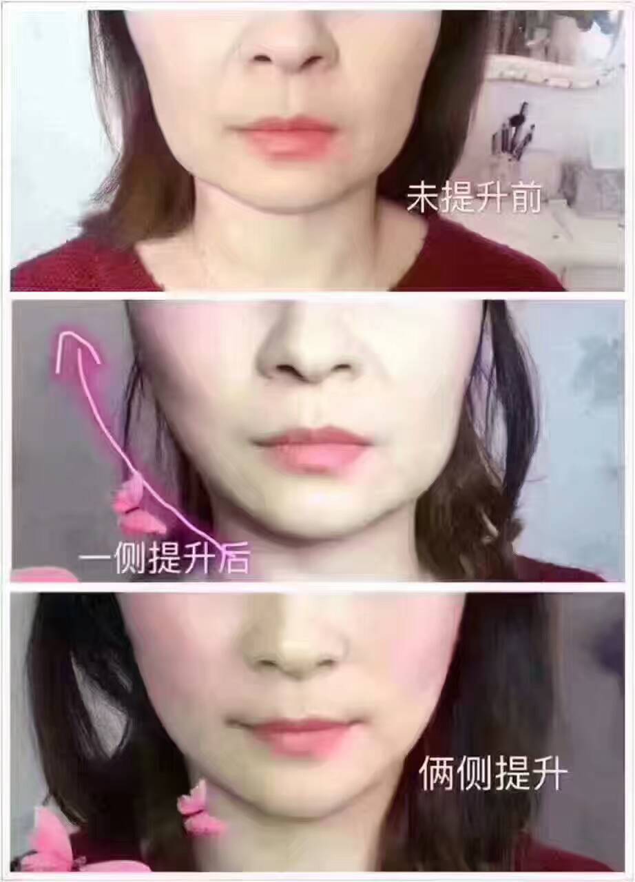 無針霧化微雕培訓(xùn)