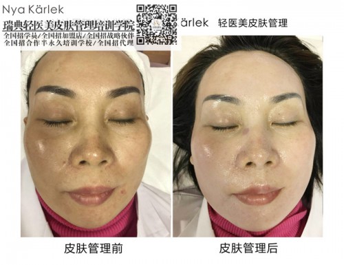 瑞典NK中國總部_瑞典NK輕醫(yī)美皮膚管理培訓加盟模式瑞典輕醫(yī)美*運營中國總部