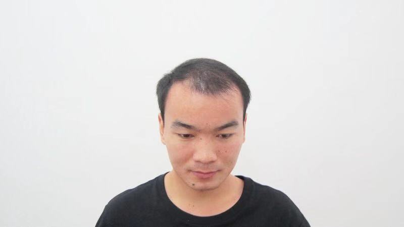 鳳岡假發(fā)織發(fā)@電話(huà)@價(jià)格